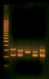 #334:  Human DNA Typing Using PCR ©Edvotek 2014