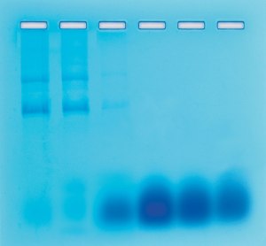 Separation of RNA and DNA by Gel Filtration Chromatography
